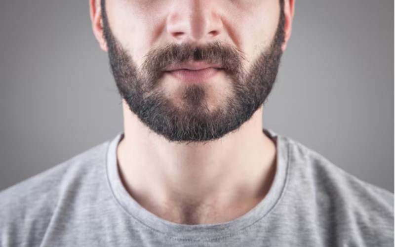 Step-By-Step Process of A Turkish Beard Transplant: